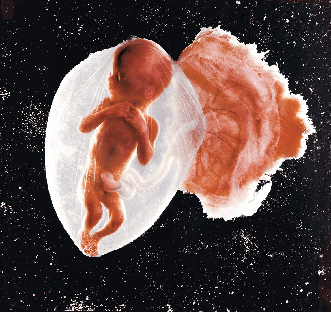 Η καταπληκτική εικόνα ενός αγέννητου μωρού 18 εβδομάδων αναδεικνύεται στη  «Φωτογραφία του Αιώνα»