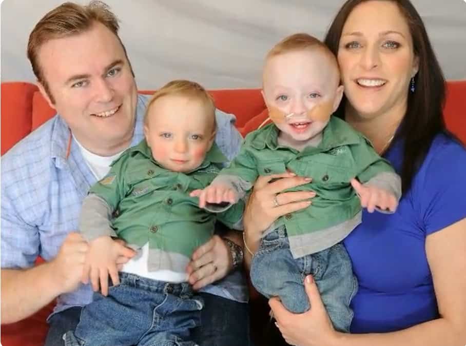 parents reject abortion of one twin 01