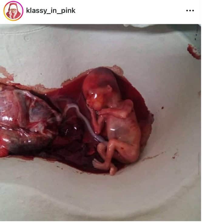 skynews abortion pills 03