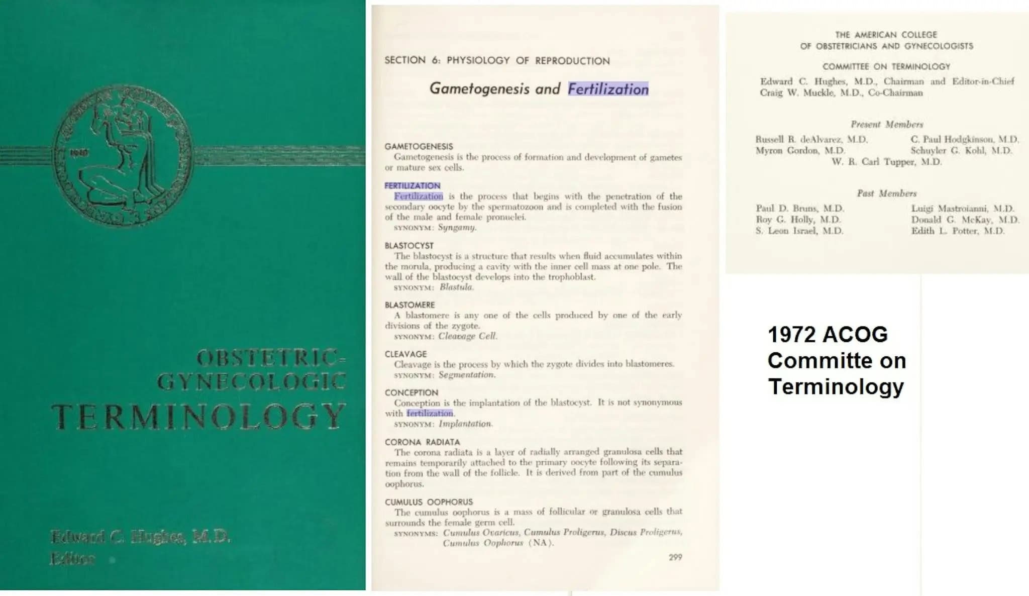 acog abortion population control redefined beginning life 02
