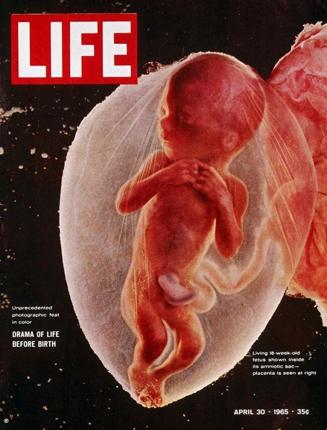 lennart nilsson fetus photography 02