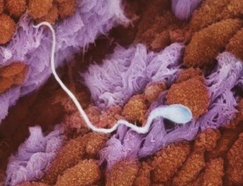 lennart nilsson fetus photography 02