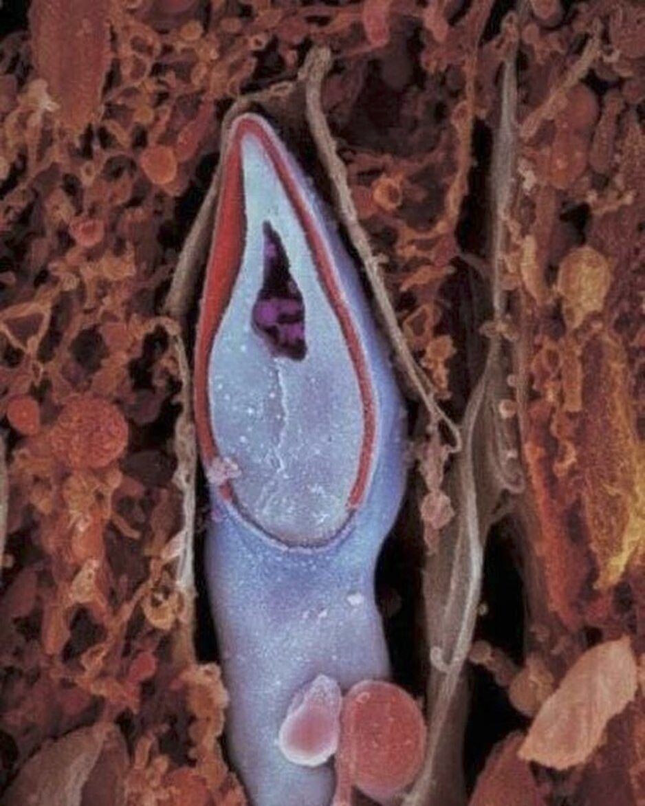 lennart nilsson fetus photography 02