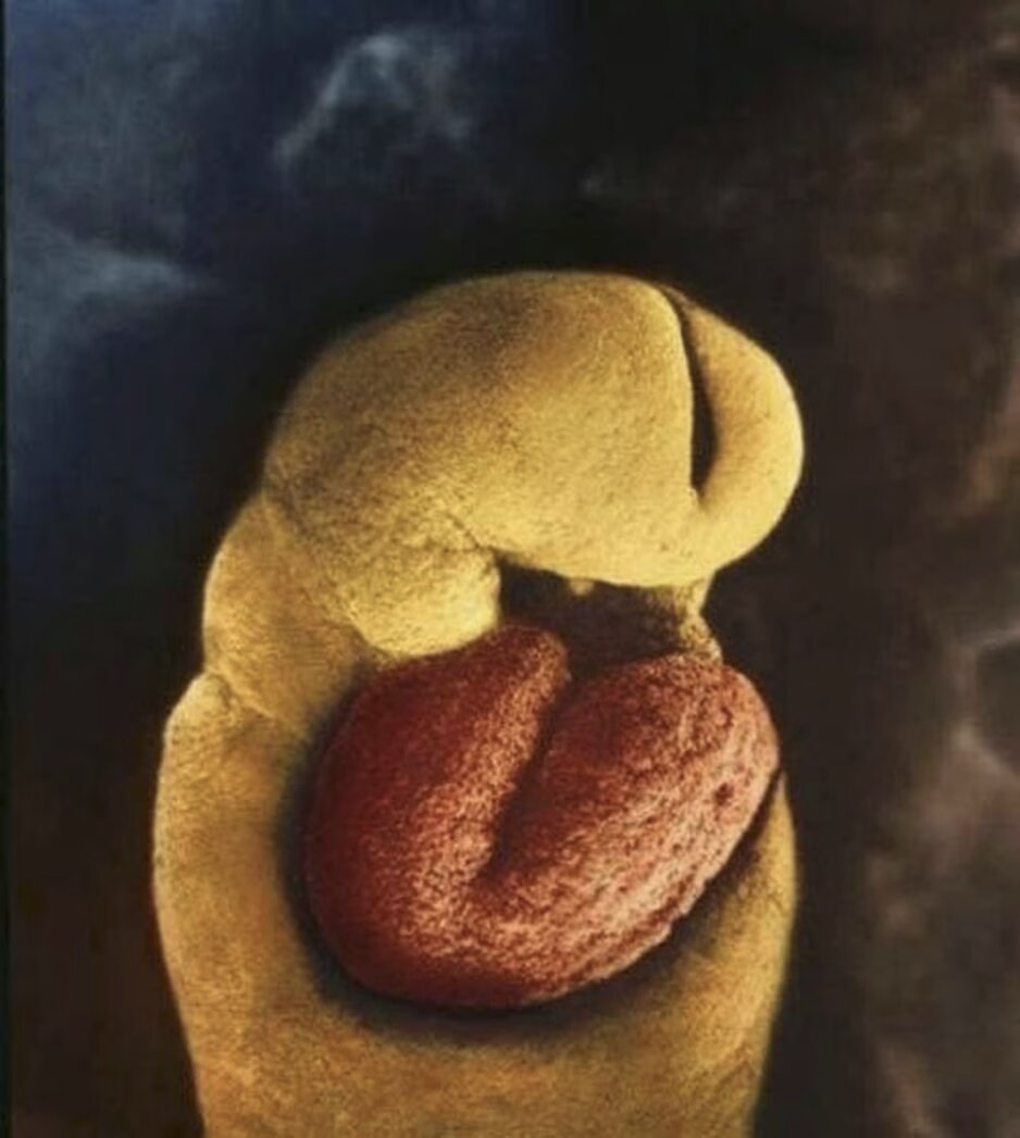 lennart nilsson fetus photography 02