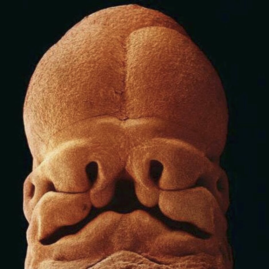 lennart nilsson fetus photography 02