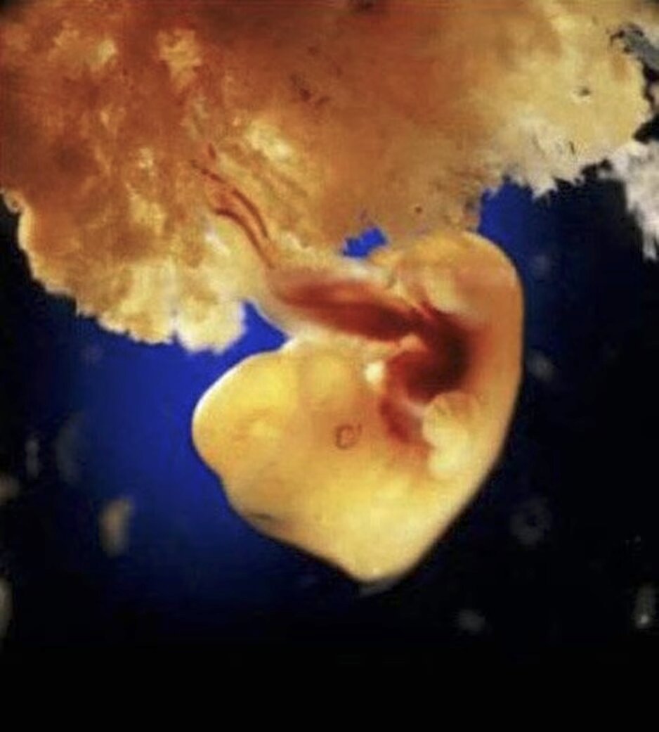 lennart nilsson fetus photography 02