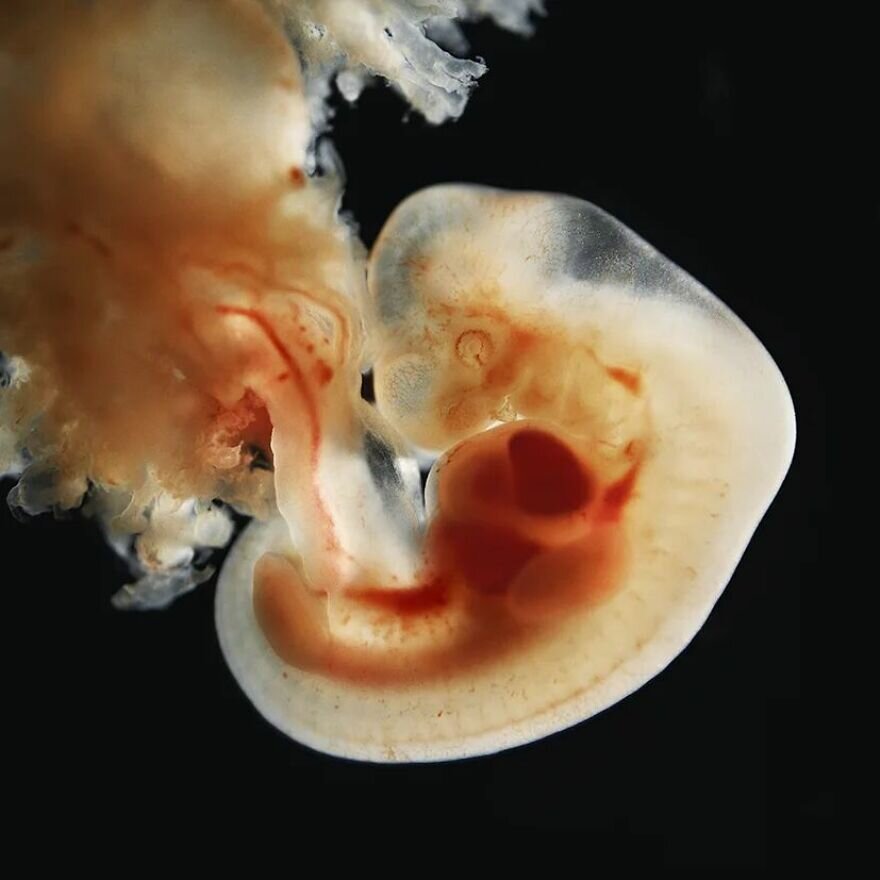 lennart nilsson fetus photography 02