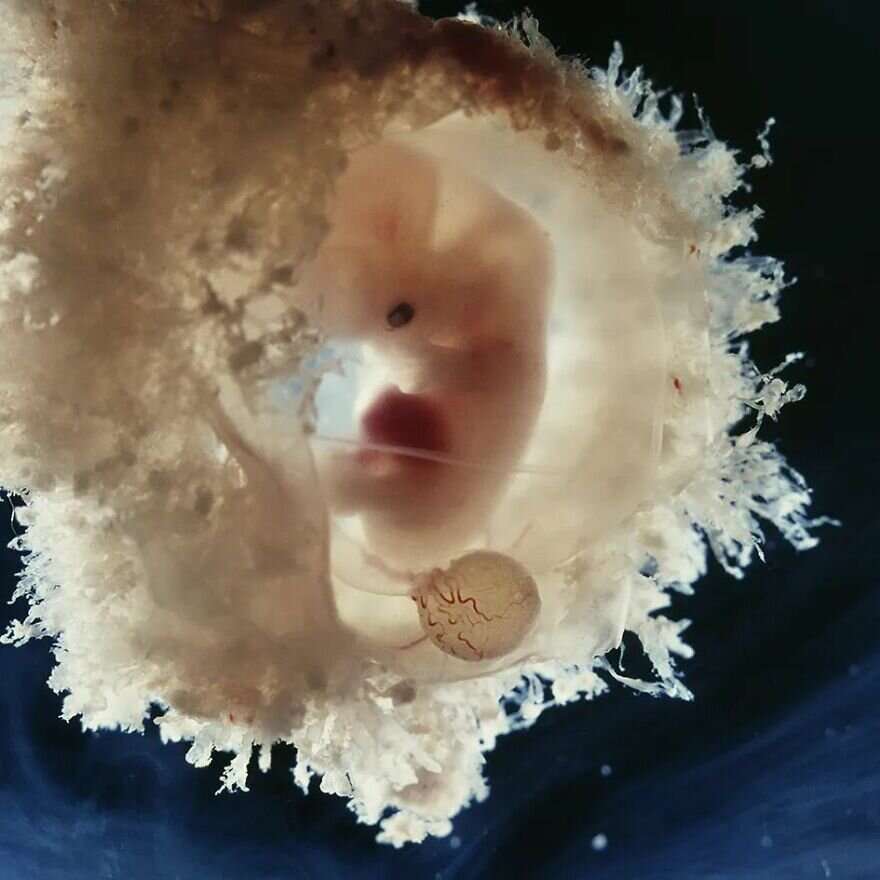 lennart nilsson fetus photography 02