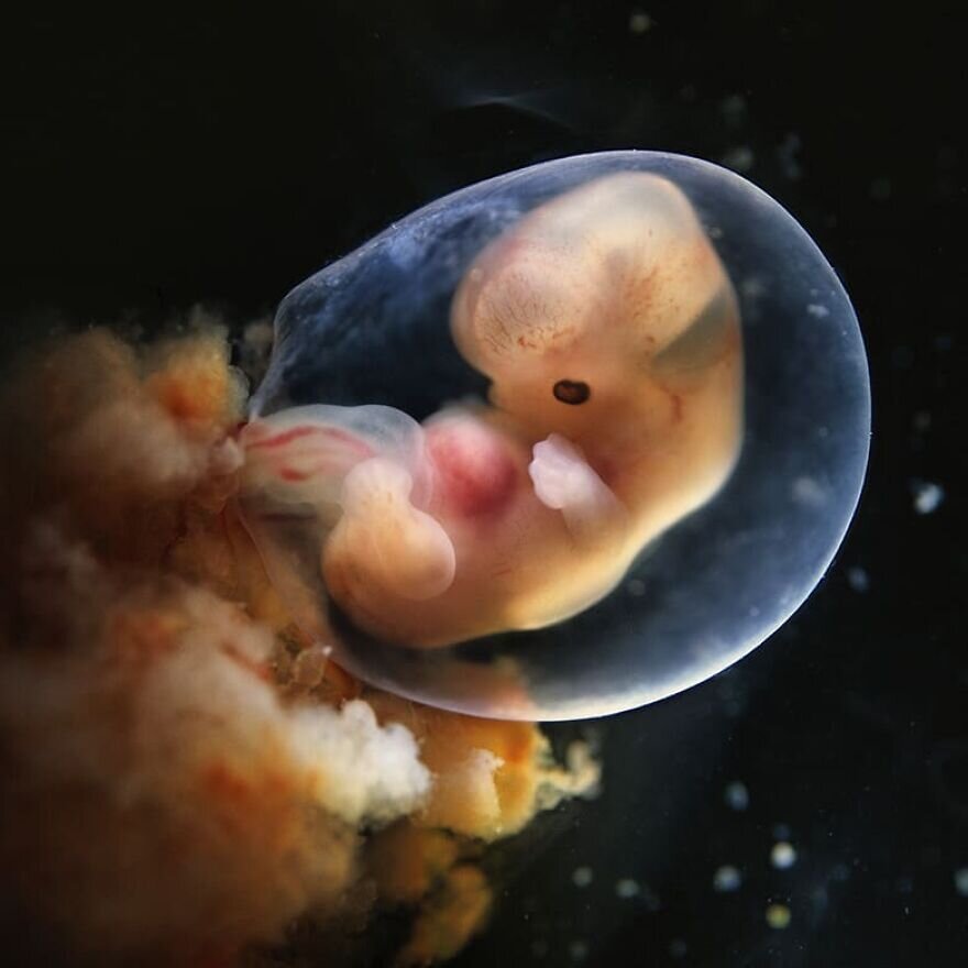 lennart nilsson fetus photography 02