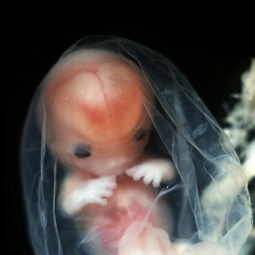 lennart nilsson fetus photography 02