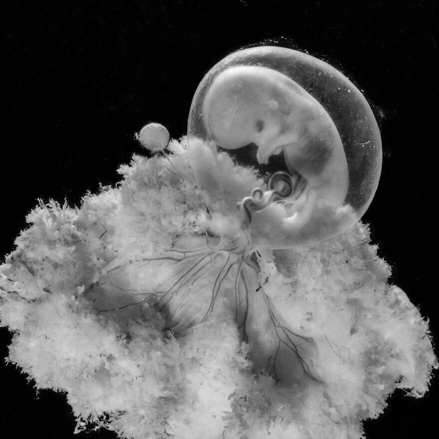 lennart nilsson fetus photography 02