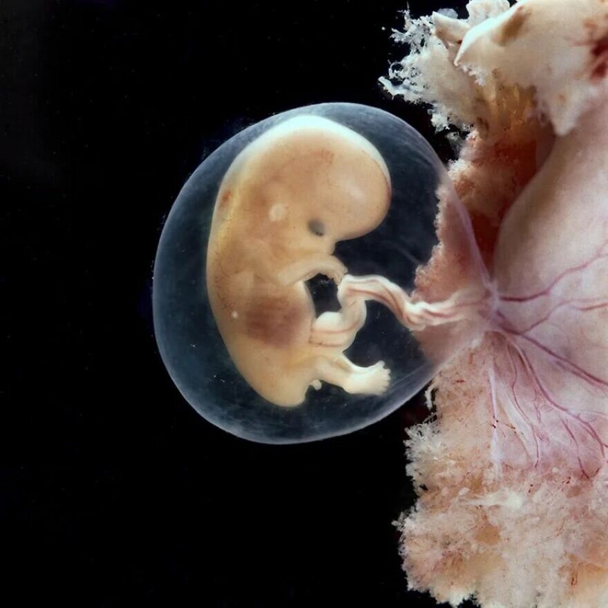 lennart nilsson fetus photography 02