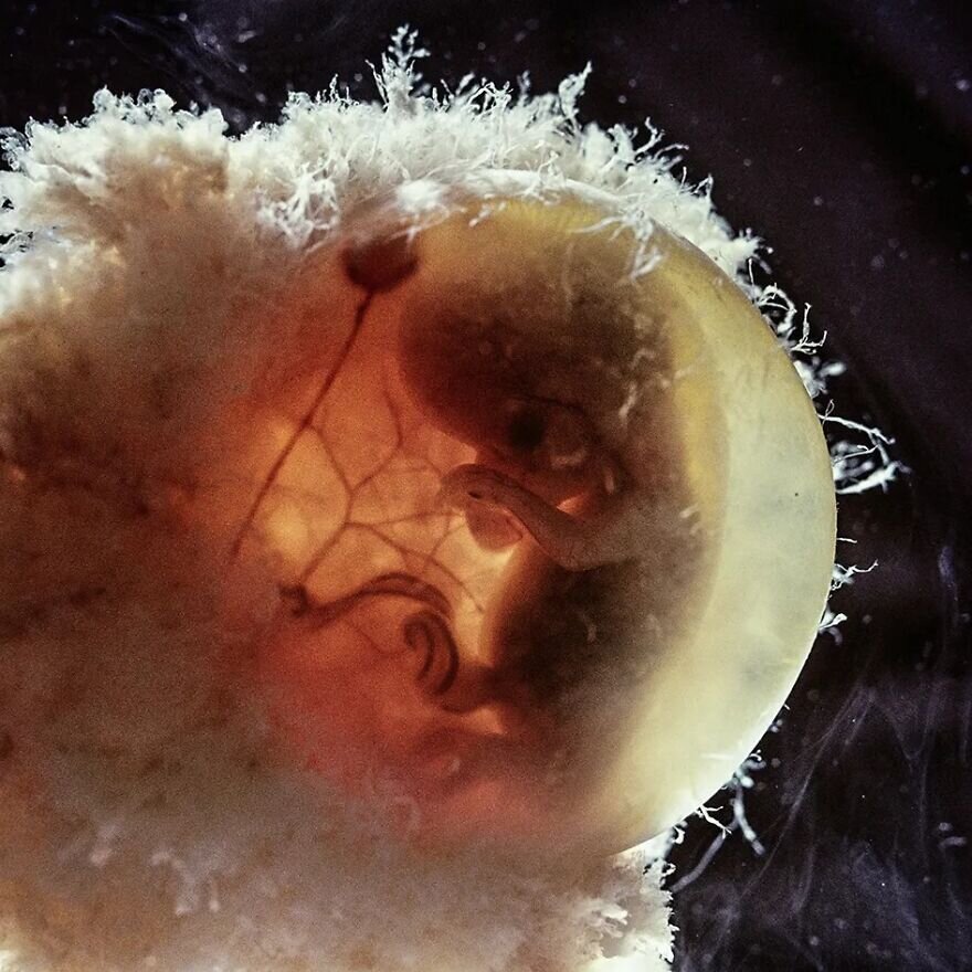 lennart nilsson fetus photography 02