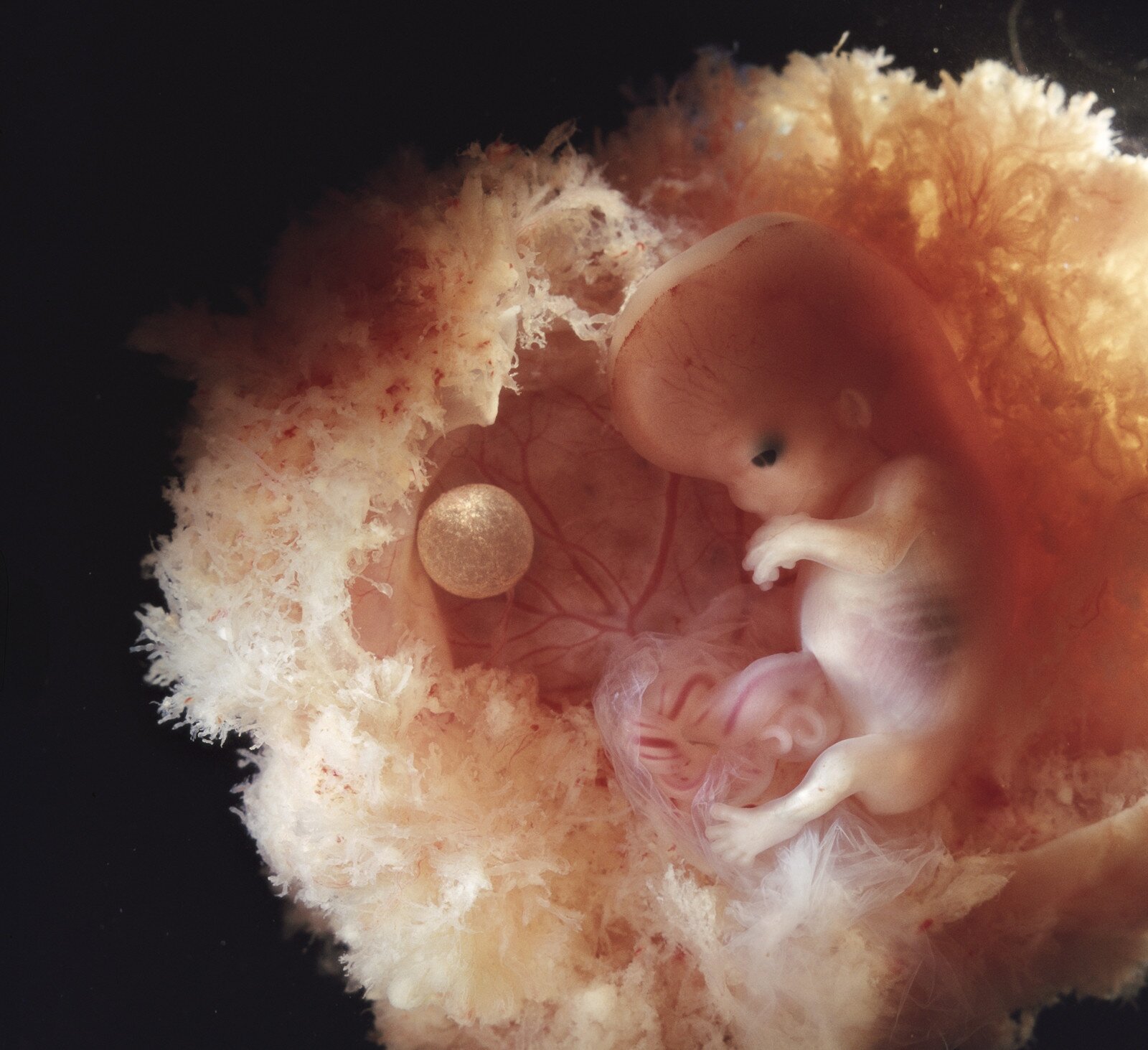 lennart nilsson fetus photography 02