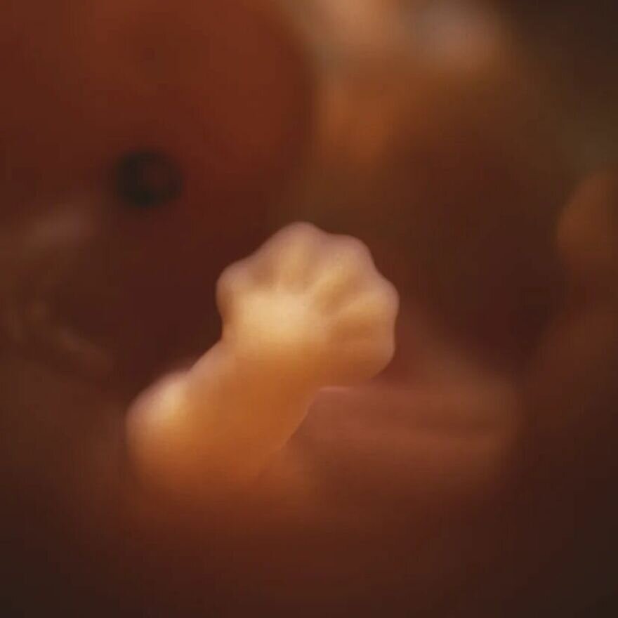 lennart nilsson fetus photography 02