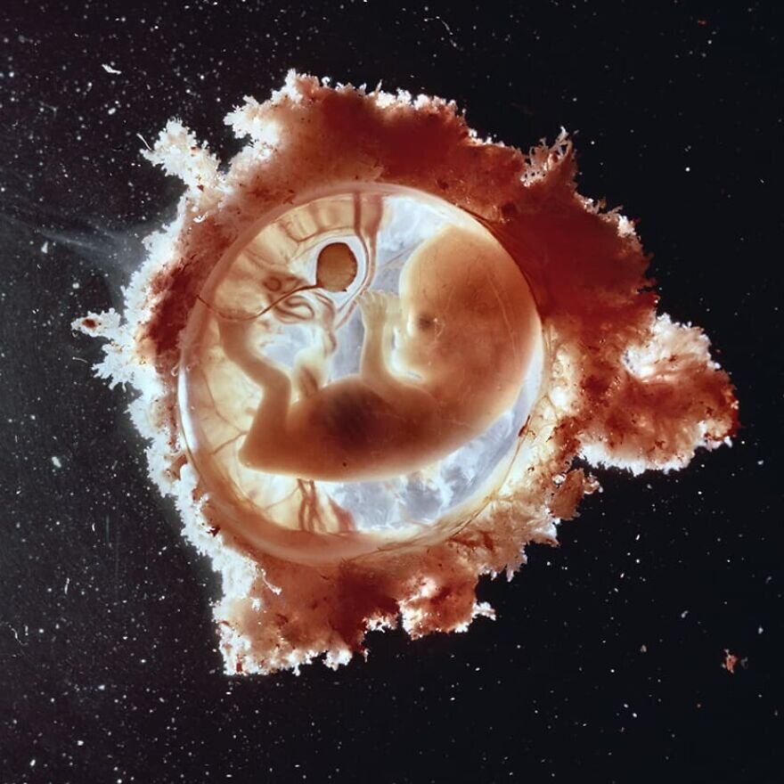 lennart nilsson fetus photography 02