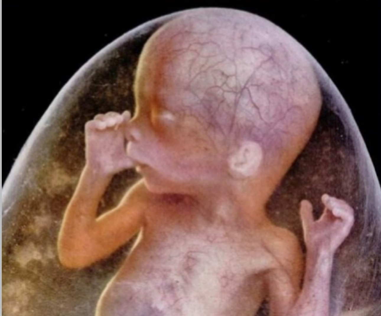 lennart nilsson fetus photography 02