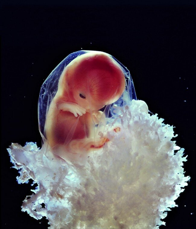 lennart nilsson fetus photography 02