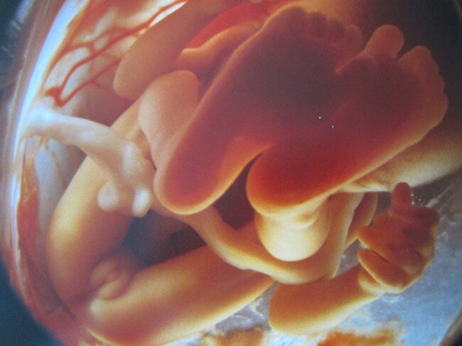 lennart nilsson fetus photography 02