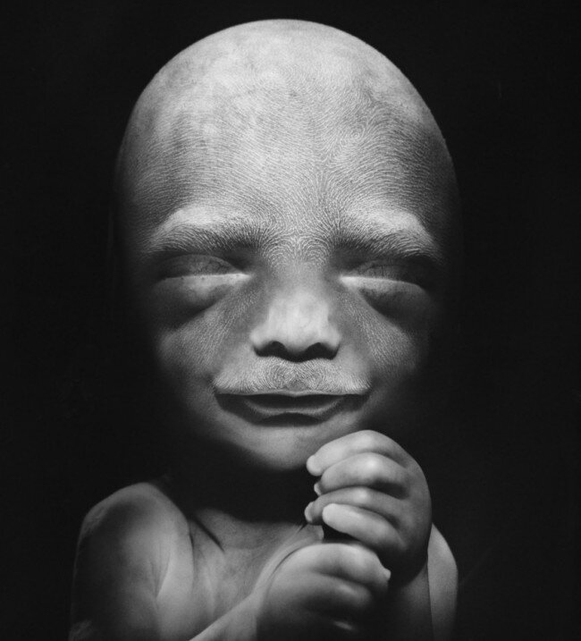 lennart nilsson fetus photography 02