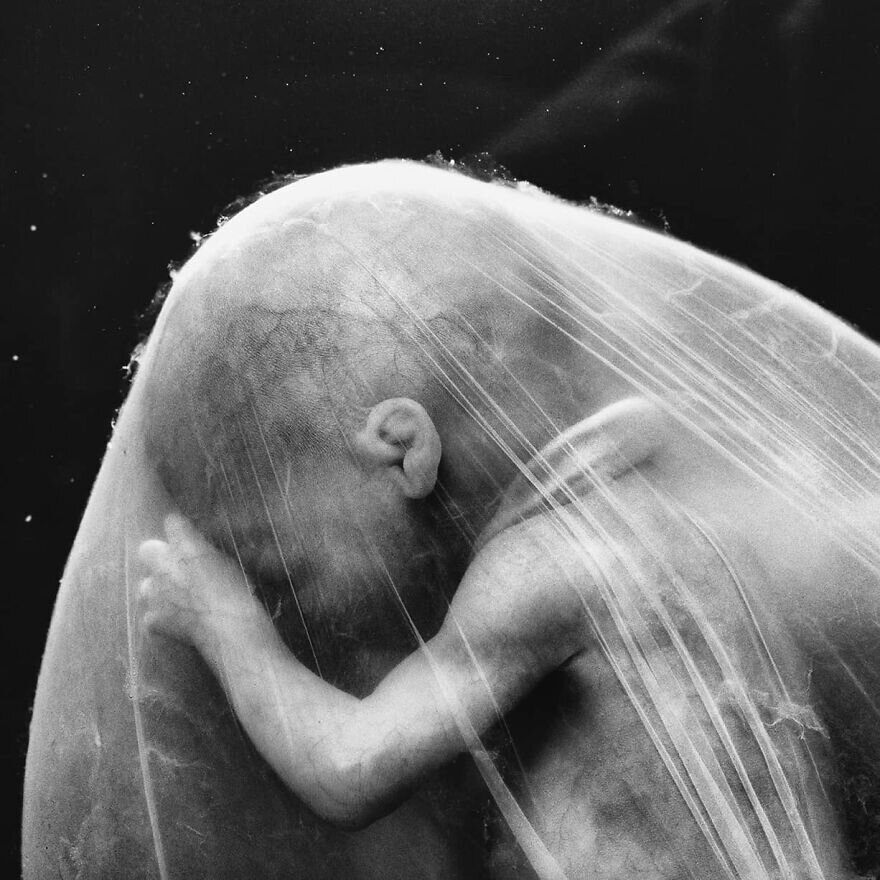 lennart nilsson fetus photography 02