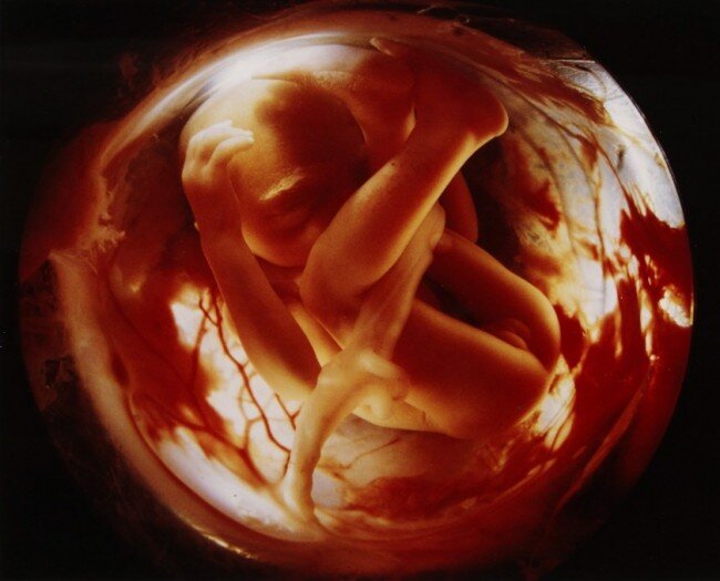 lennart nilsson fetus photography 02