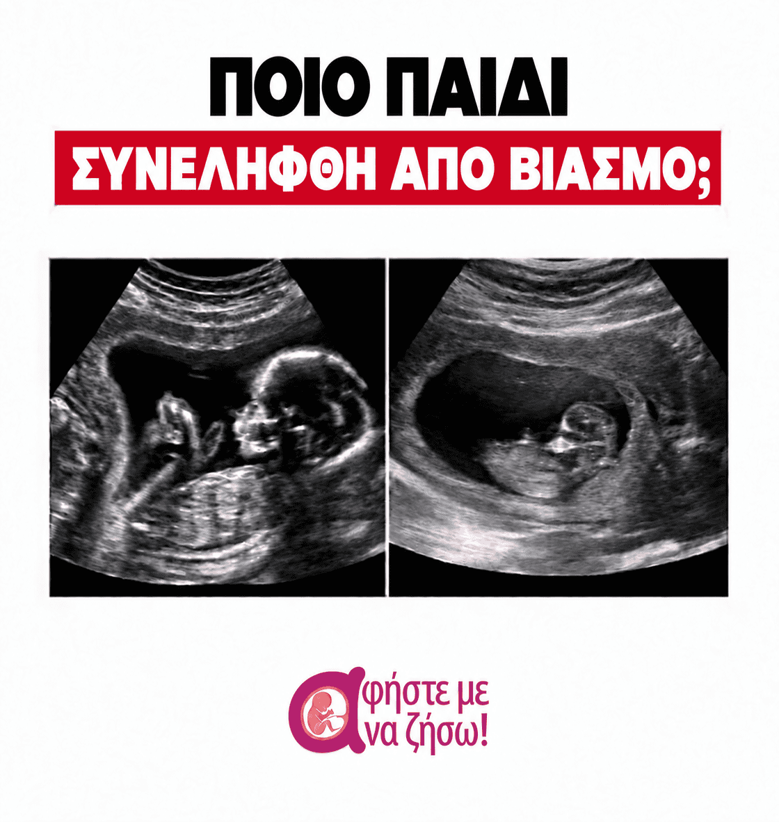 after a brutal rape she rejected abortion 02