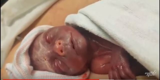 baby elliot was born premature and doctors refused to help himjpg