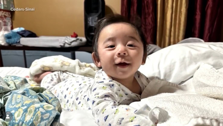 cedars sinai doctors deliver healthy baby in extremely rare abdominal ectopic pregnancy 02