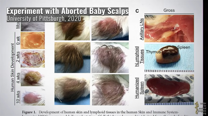 five month old baby survived 02