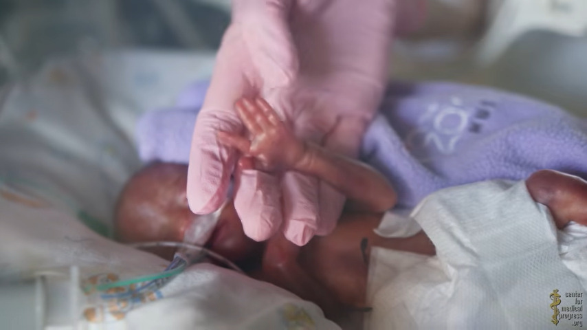 five month old baby survived 02